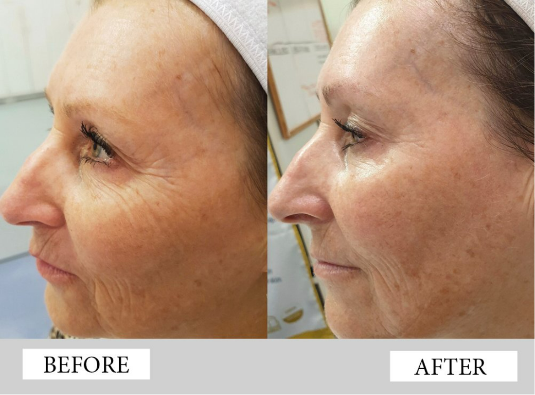 Organic 24K Gold 4-In-1 Skincare Pack