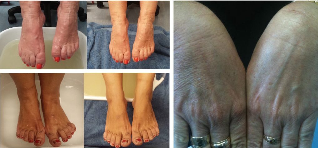 magnesium-before-and-afters