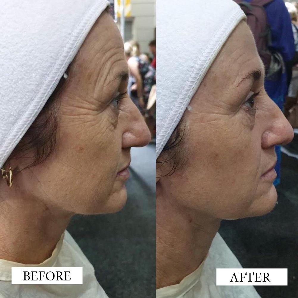 Before and After Artworks