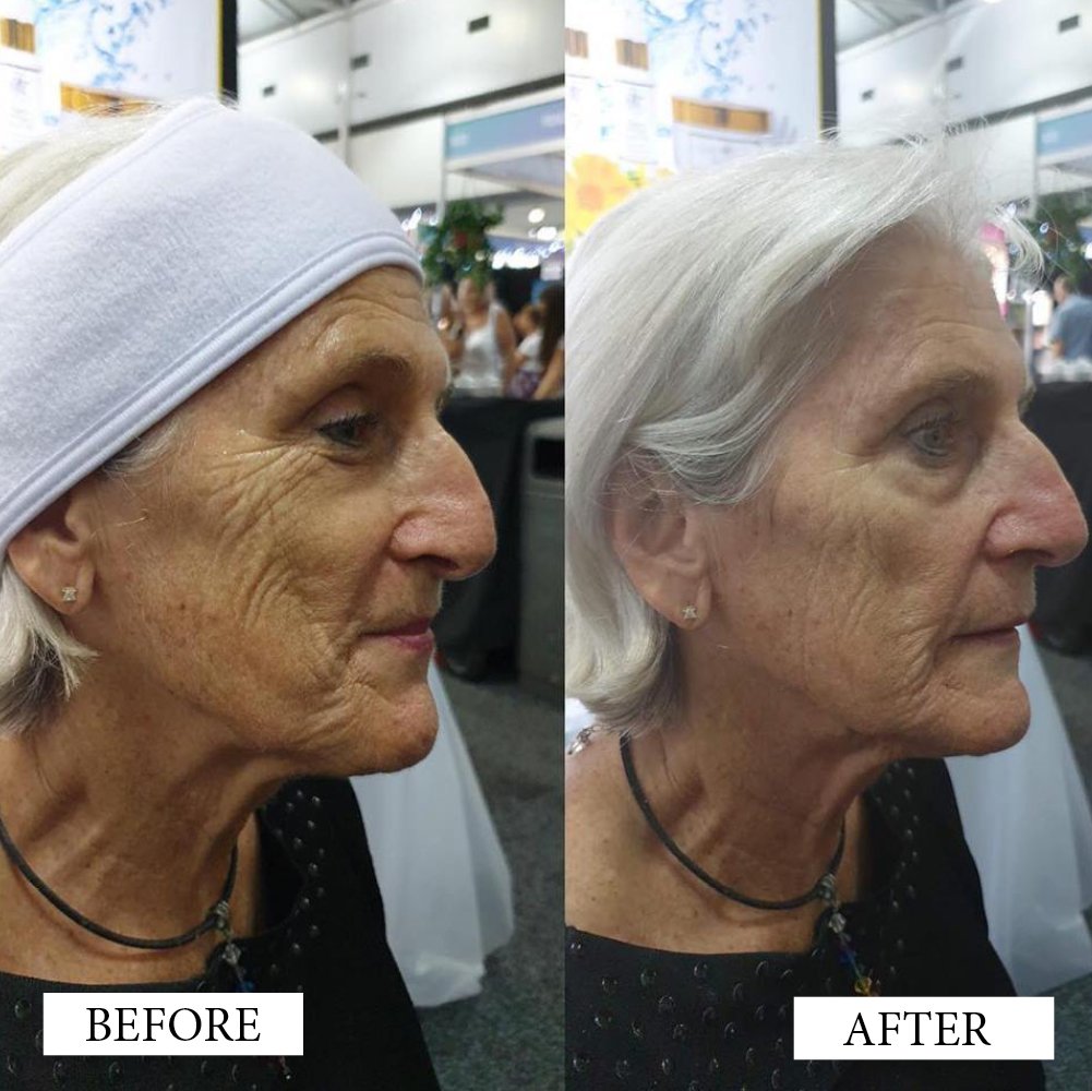 Before and After Artworks2