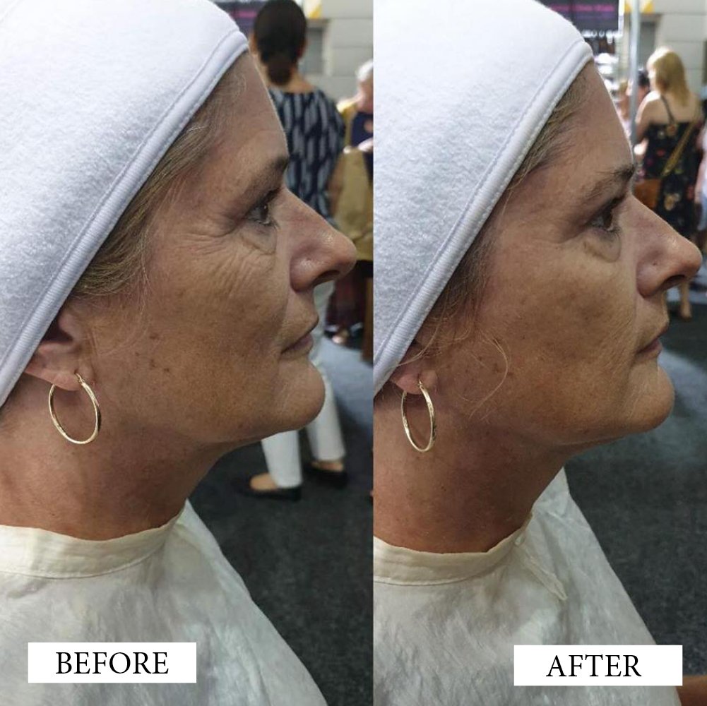 Before and After Artworks3