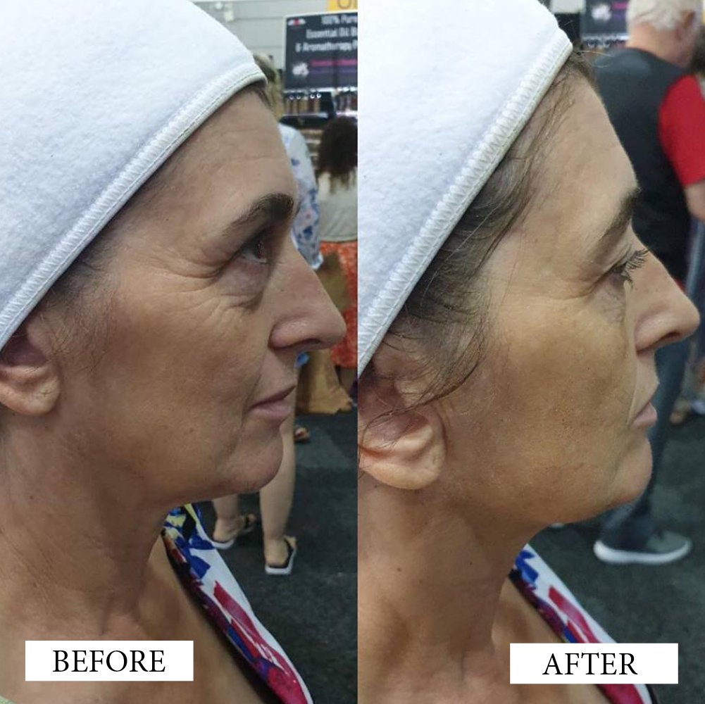 Before and After Artworks4