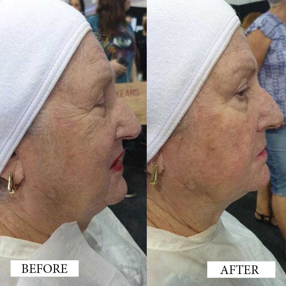 Before and After Artworks5