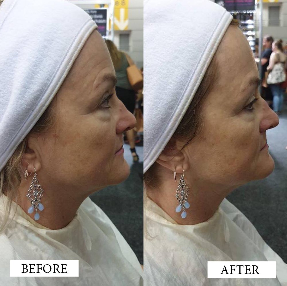 Before and After Artworks6