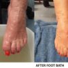 Magnesium Foot Bath 1 1