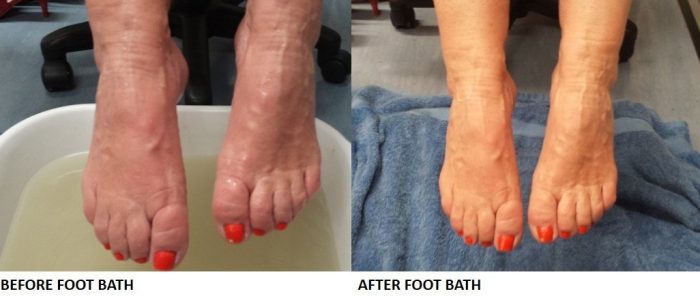 Magnesium Foot Bath 1
