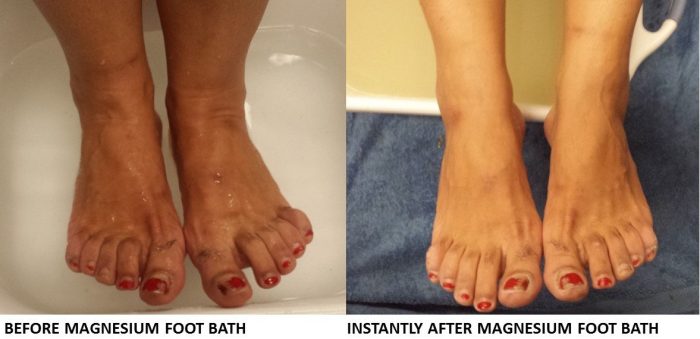 Magnesium Foot Bath 2 1 1.jpg 1 1